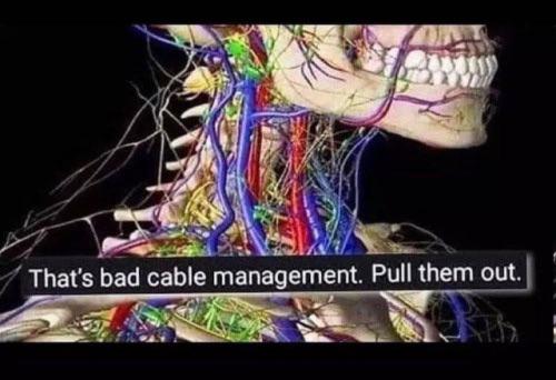 Cable Management: Evolution Edition