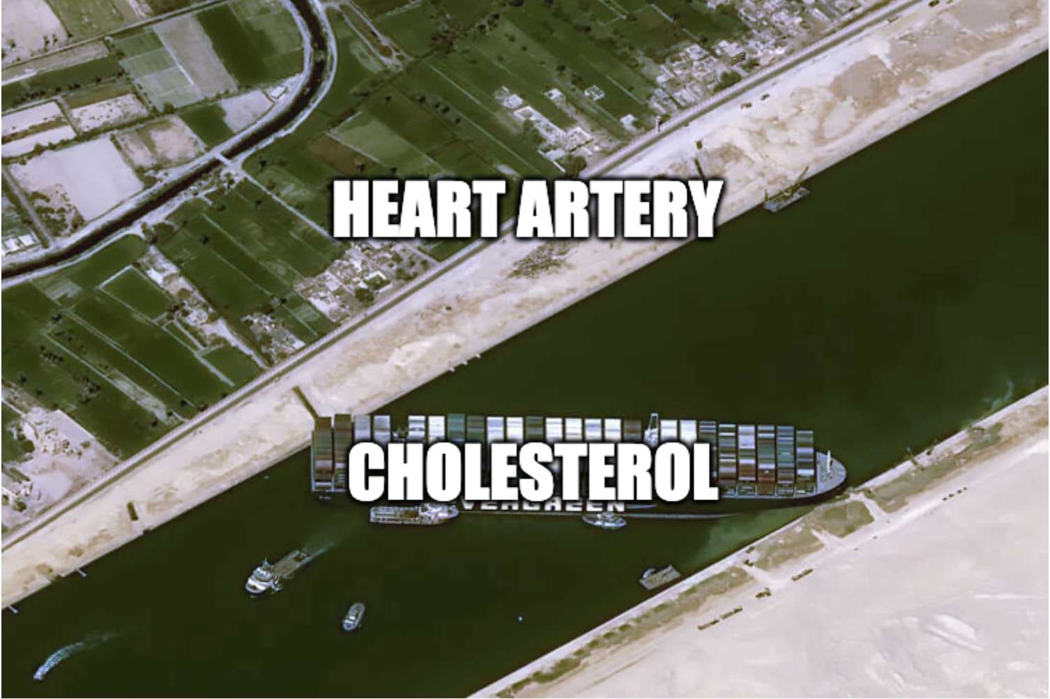 The Cardiac Suez Crisis