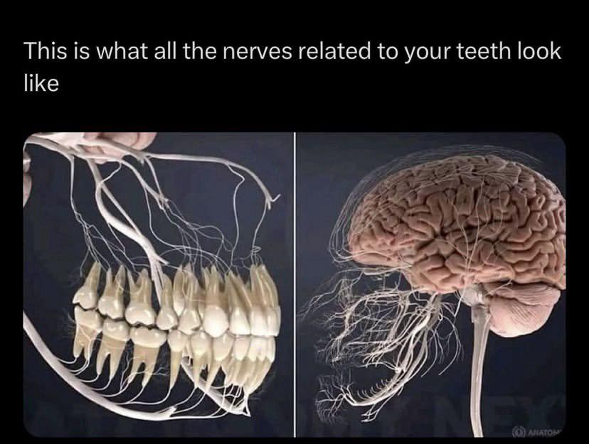 Toothaches Are A Direct Line To Your Brain