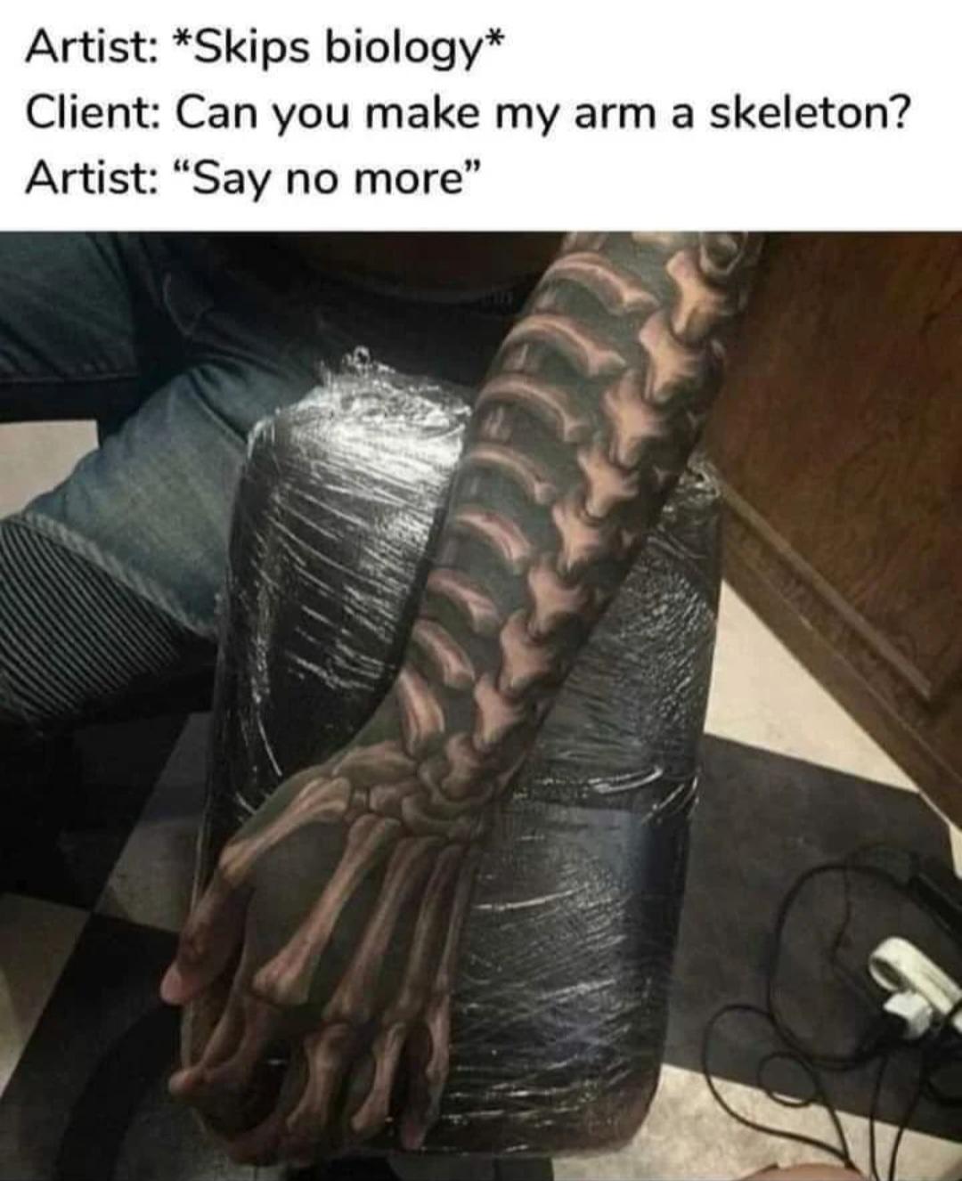 Spine-tingling Anatomical Disaster