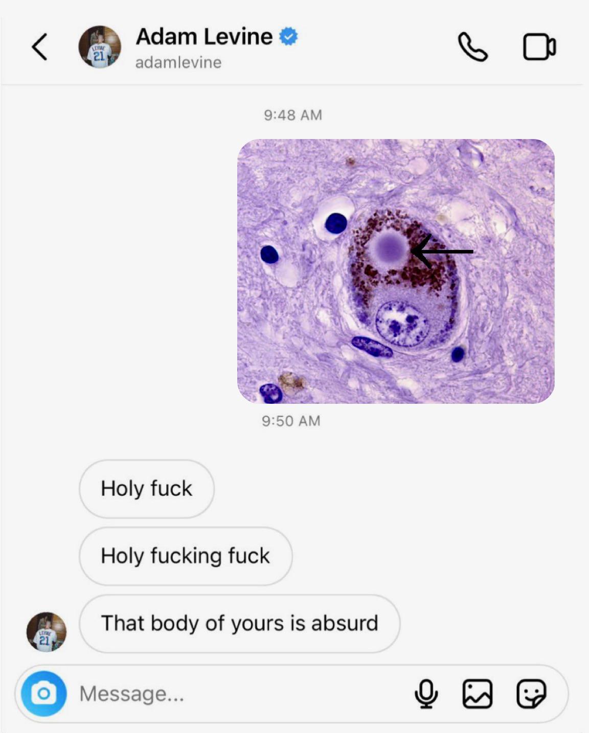 When Cells Look Sus