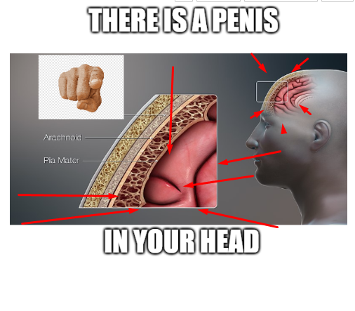 Anatomical Déjà Vu