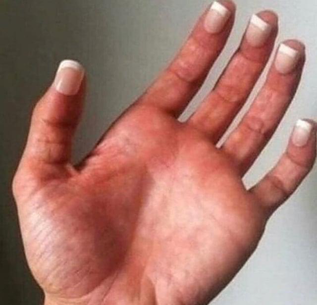 POV: You Have Just Confidently Read The Definition Of Chirality For The First Time
