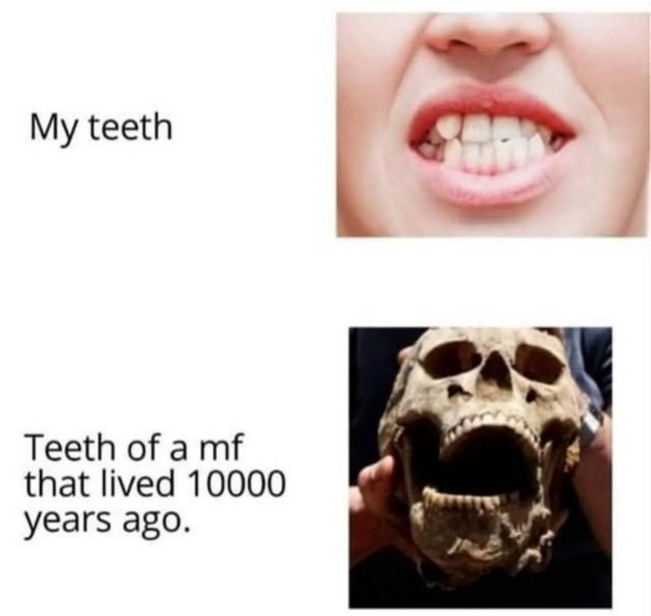 The Dental Downgrade: Evolution's Cruel Joke