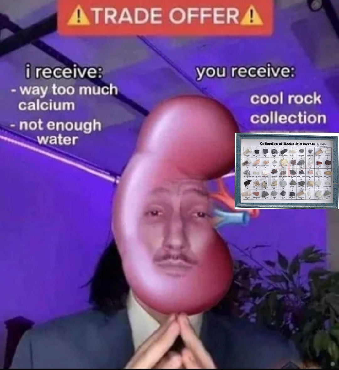 The Only Rock Collection I Didn't Ask For