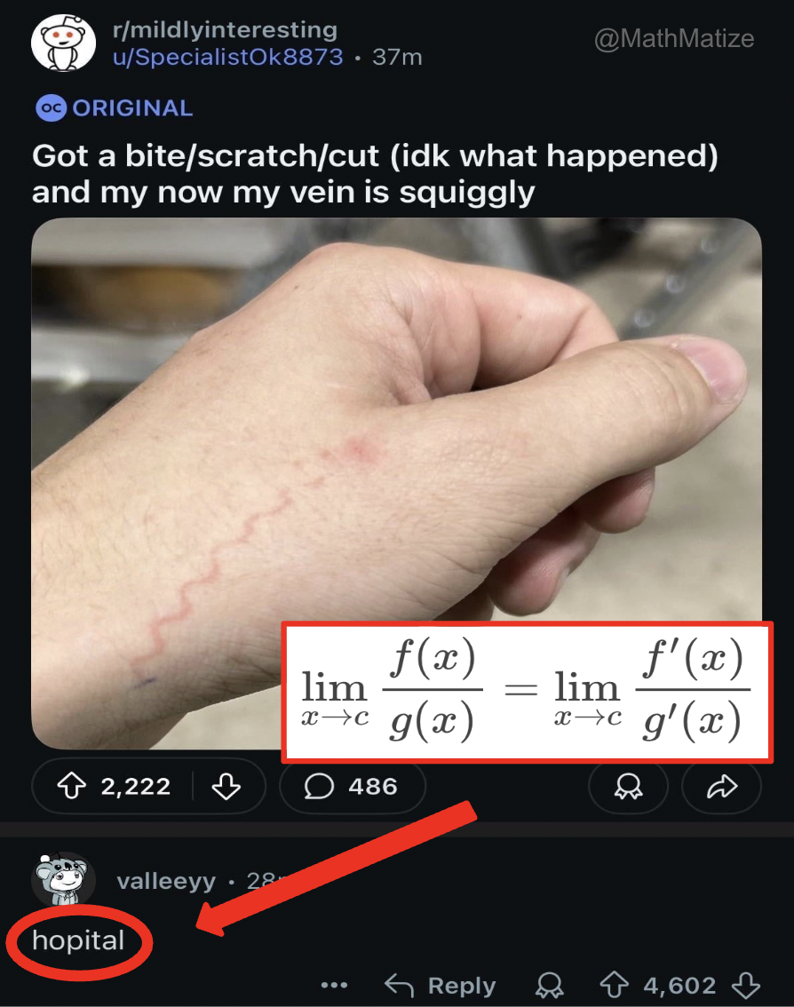 Definitely L'Hôpital's Rule